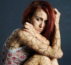 אישה עם סדקים על העור כמטאפורה למצב הנפשי המתערער של מגורשת "לצידך" שאין להן מסגרת טיפולית
